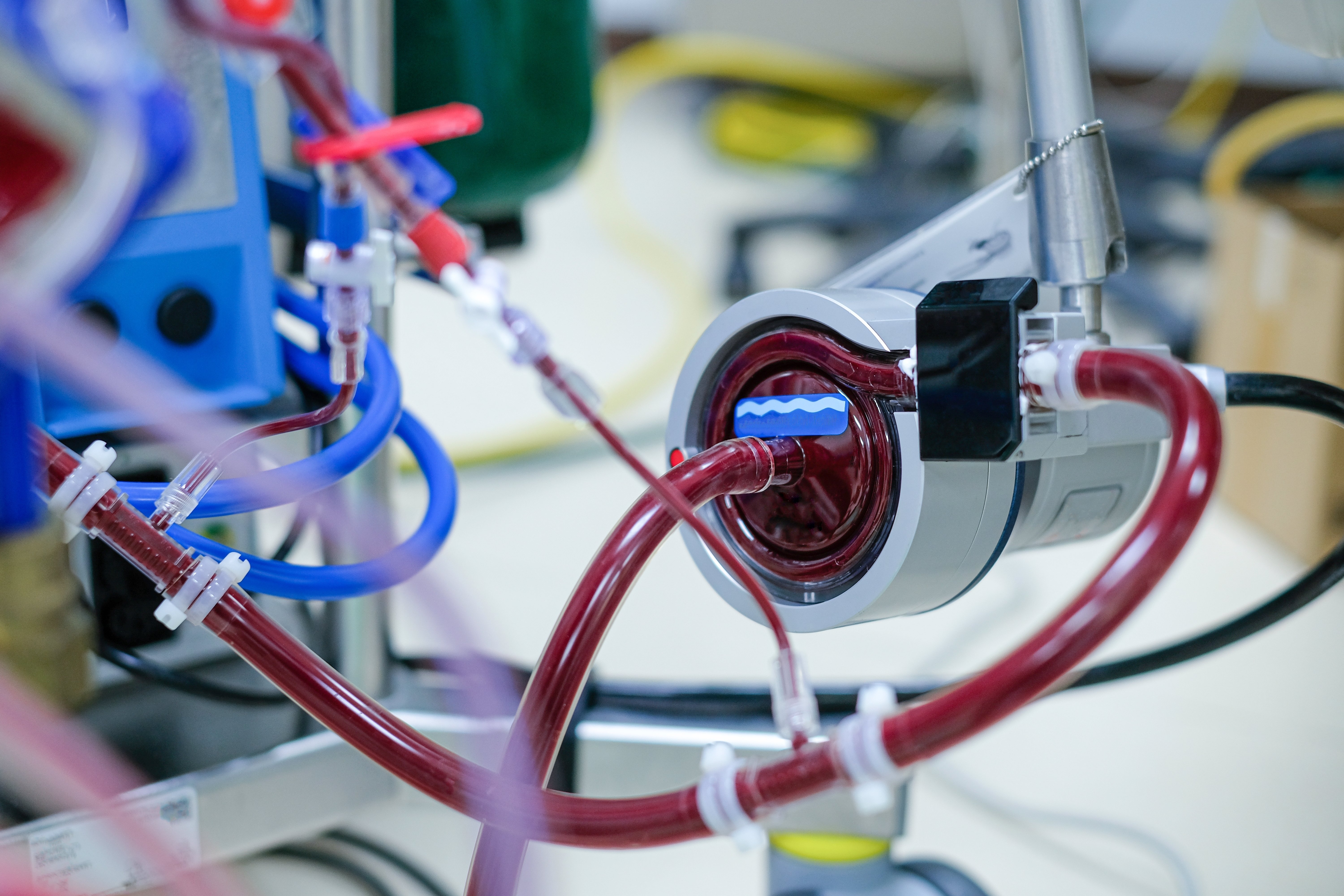 centrifugal-pump-ECMO