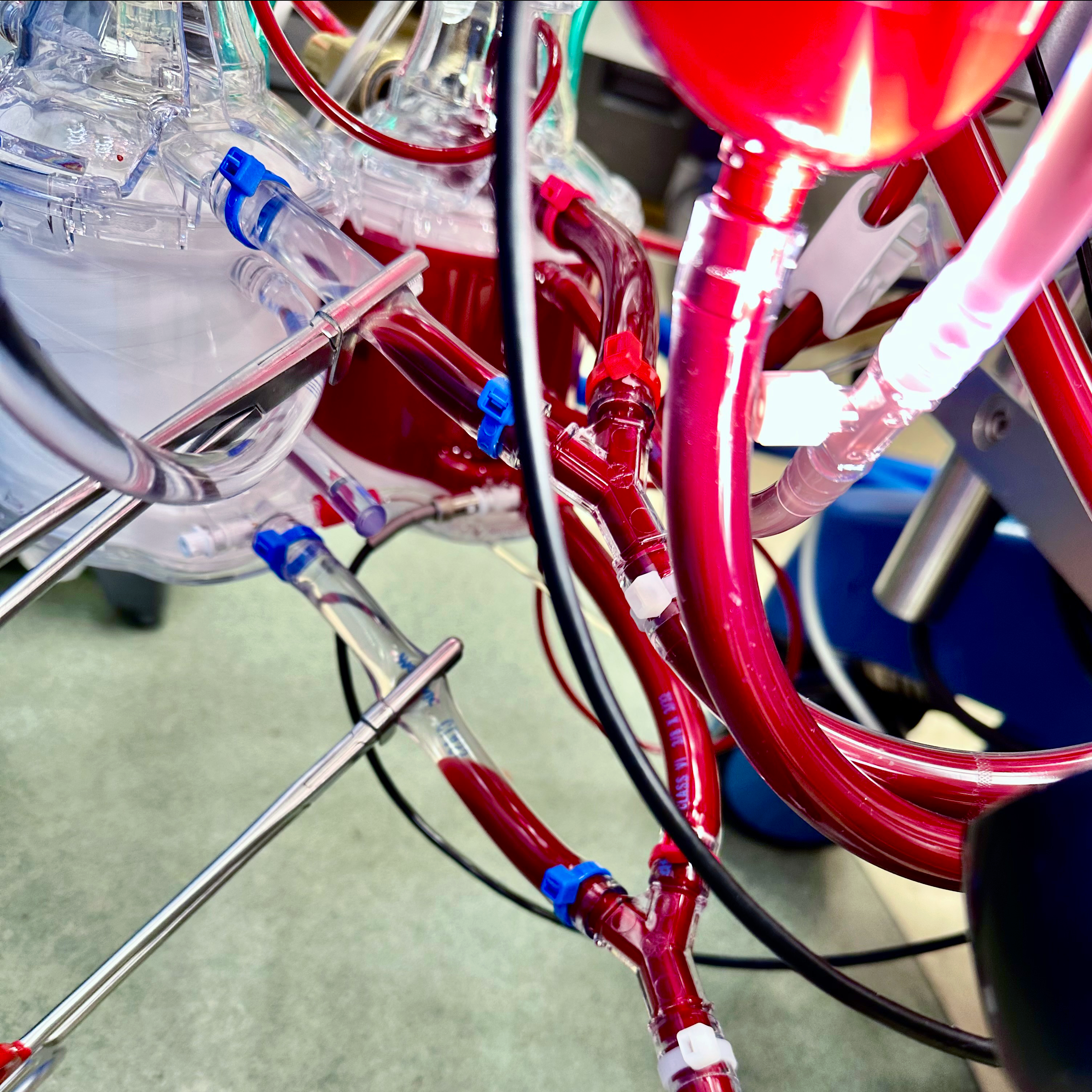 two-oxygenators-cardiopulmonary-bypass-updated-color
